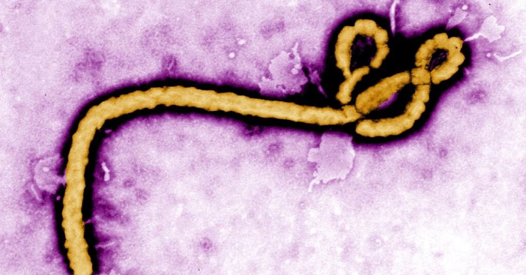 ebola virus disease