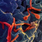 ebola virus disease kenya